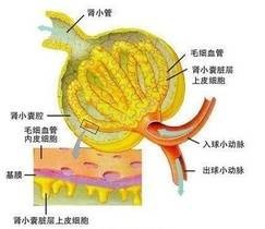 儿童紫癜性肾炎