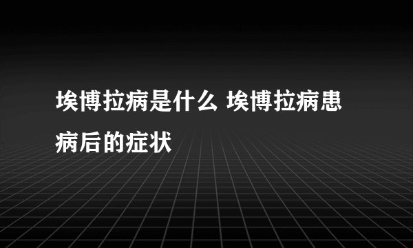 埃博拉病是什么 埃博拉病患病后的症状