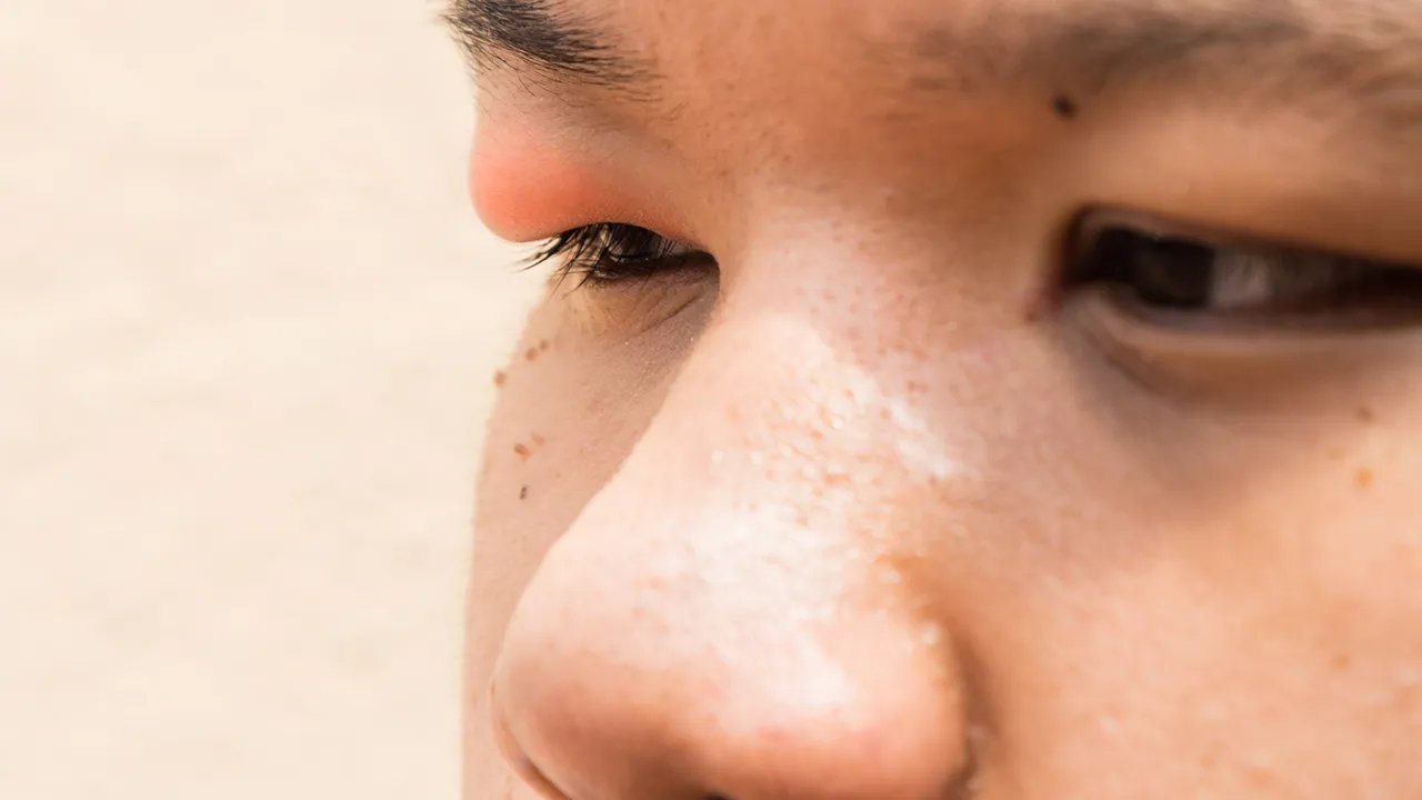 孩子的眼睛疼是怎么回事？