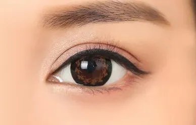 做韩式三点定位双眼皮多少价格
