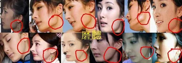 杨幂整容了吗?