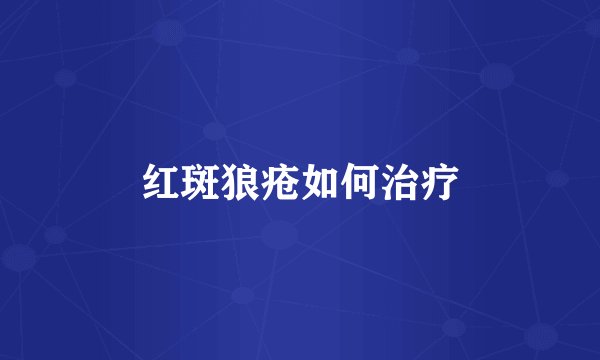 红斑狼疮如何治疗