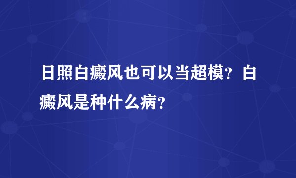 日照白癜风也可以当超模?白癜风是种什么病?