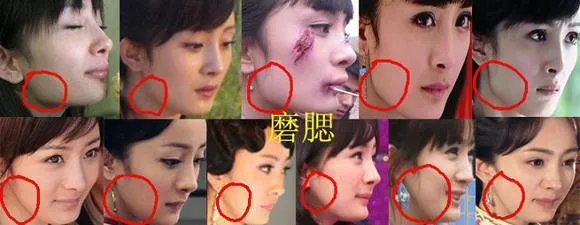 杨幂整容了吗?