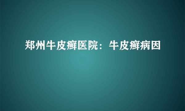 郑州牛皮癣医院：牛皮癣病因