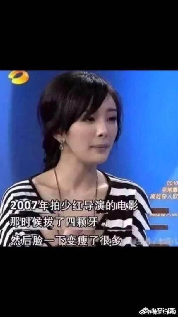 杨幂整容了吗?