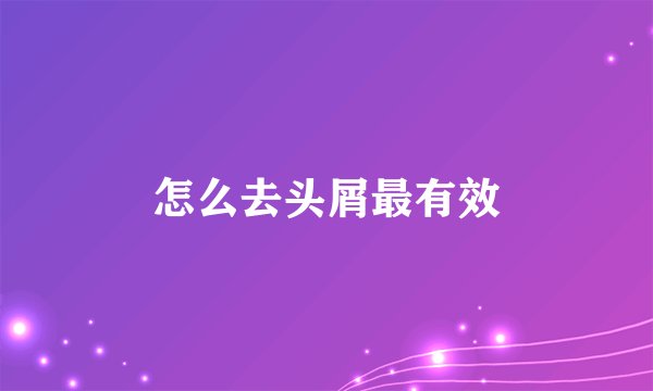 怎么去头屑最有效