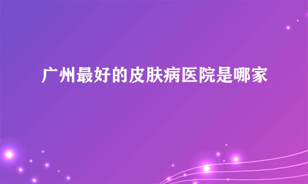 广州最好的皮肤病医院是哪家