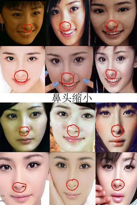 杨幂整容了吗?