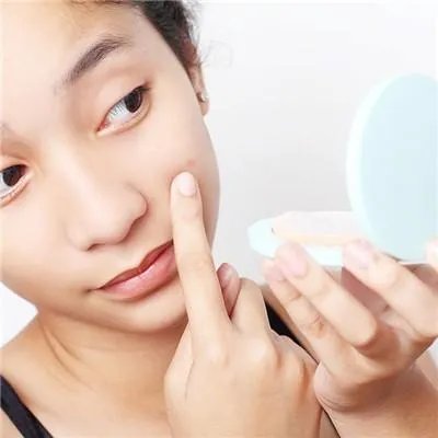 粉刺是什么样的