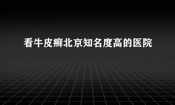 看牛皮癣北京知名度高的医院