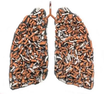 肺纤维化的症状有哪些 肺纤维化的4个症状介绍