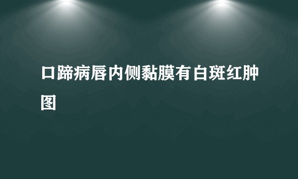 口蹄病唇内侧黏膜有白斑红肿图