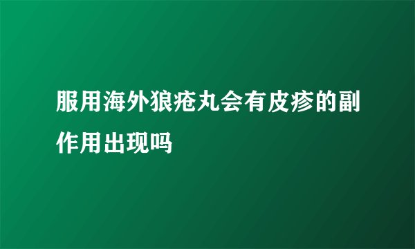 服用海外狼疮丸会有皮疹的副作用出现吗