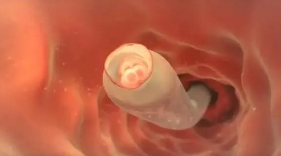 北京试管助孕-北京海淀区妇幼保健院生殖科试管婴儿怎么做?