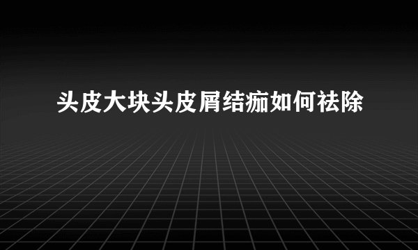 头皮大块头皮屑结痂如何祛除