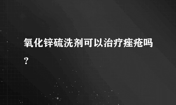 氧化锌硫洗剂可以治疗痤疮吗？