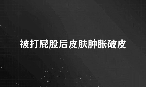 被打屁股后皮肤肿胀破皮