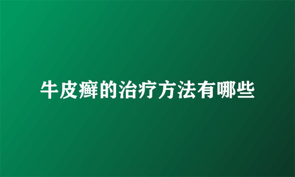牛皮癣的治疗方法有哪些