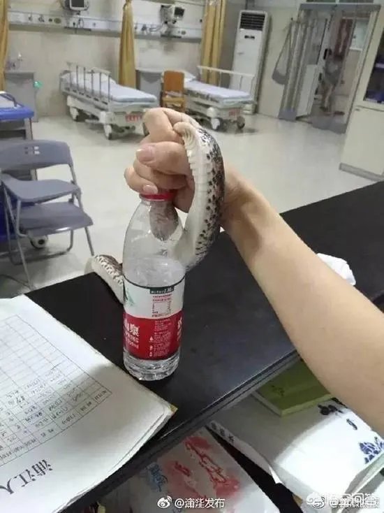 浙江23岁姑娘被蛇咬后徒手握蛇看急诊,离院时带走称将其放生,对此你怎么看?