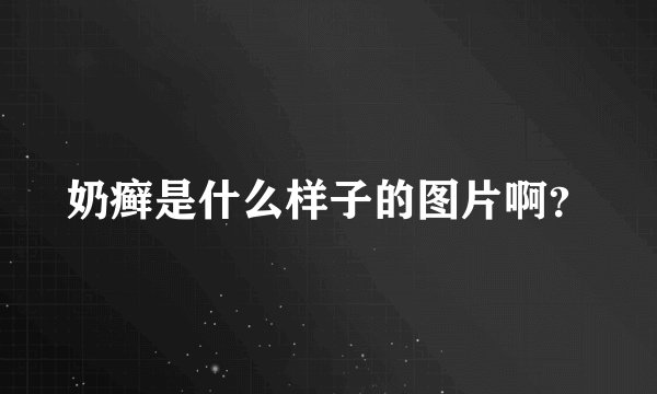 奶癣是什么样子的图片啊？
