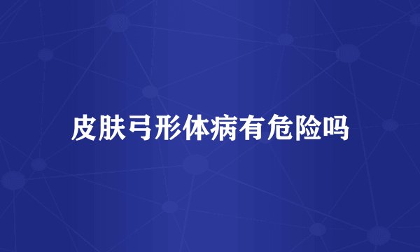 皮肤弓形体病有危险吗