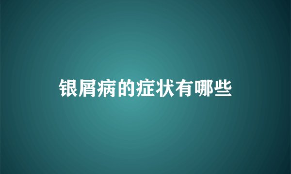 银屑病的症状有哪些