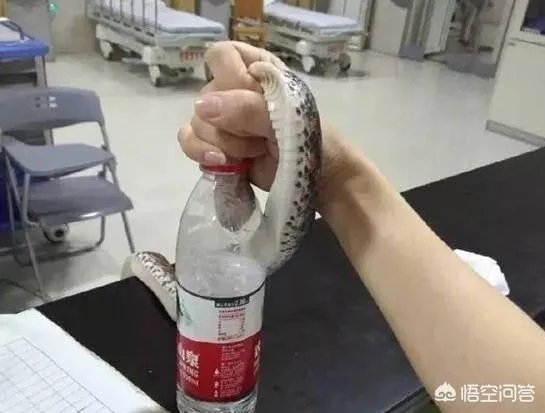 浙江23岁姑娘被蛇咬后徒手握蛇看急诊,离院时带走称将其放生,对此你怎么看?