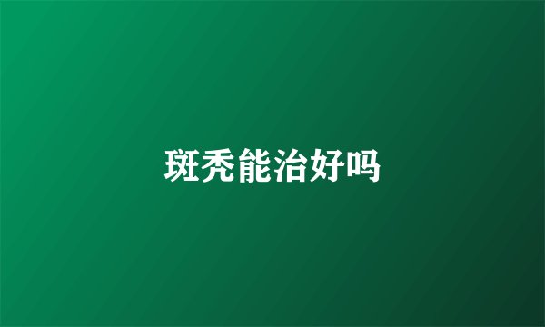 斑秃能治好吗