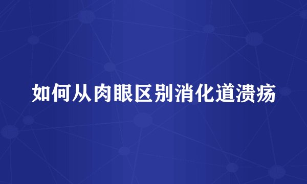 如何从肉眼区别消化道溃疡