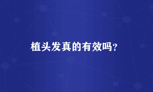 植头发真的有效吗?