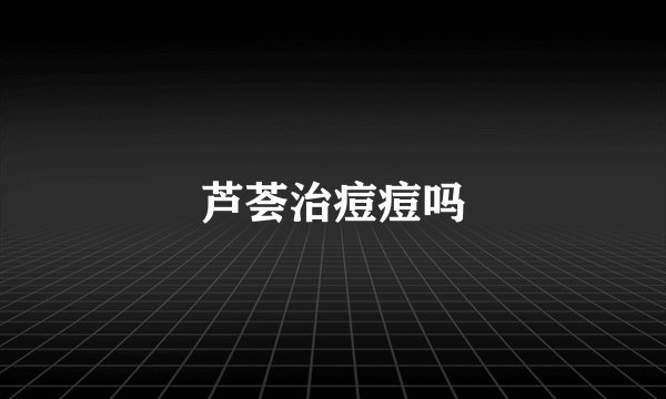 芦荟治痘痘吗
