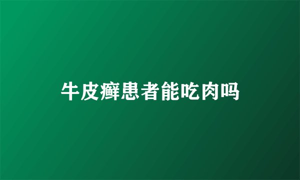 牛皮癣患者能吃肉吗