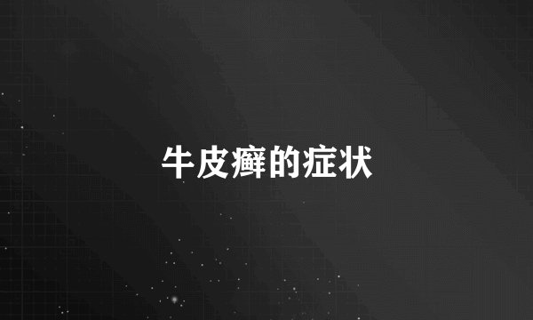牛皮癣的症状
