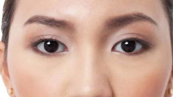 孟广美:明星整形怎么样了？