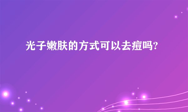 光子嫩肤的方式可以去痘吗?