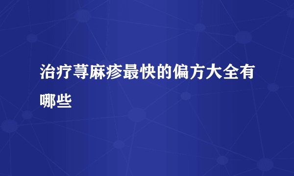 治疗荨麻疹最快的偏方大全有哪些