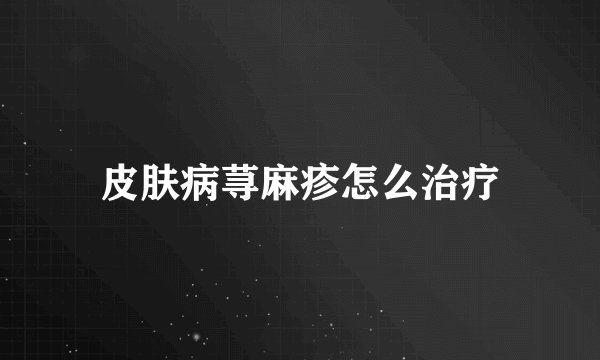 皮肤病荨麻疹怎么治疗