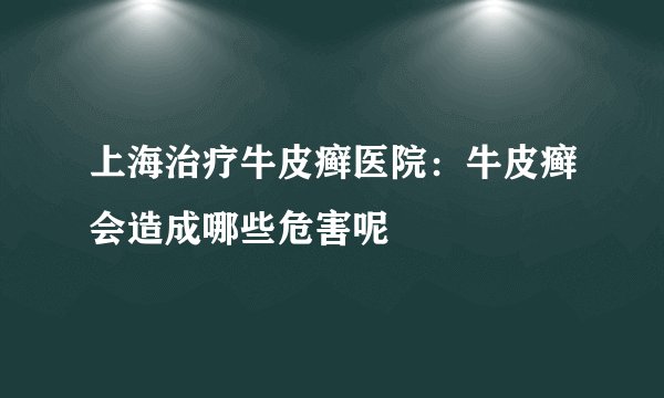 上海治疗牛皮癣医院:牛皮癣会造成哪些危害呢