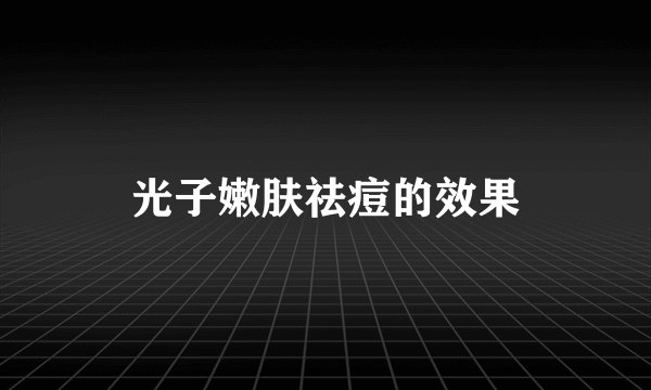 光子嫩肤祛痘的效果