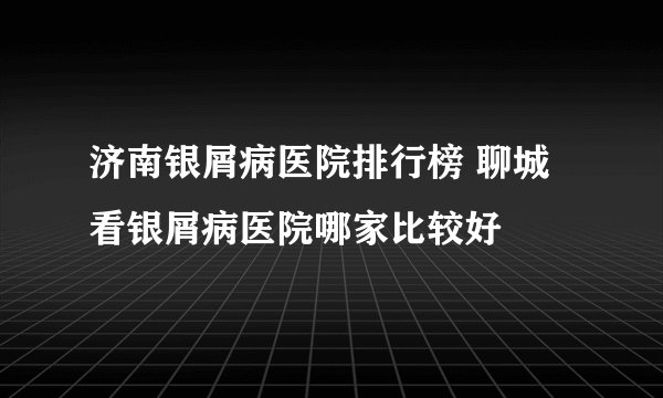济南银屑病医院排行榜 聊城看银屑病医院哪家比较好