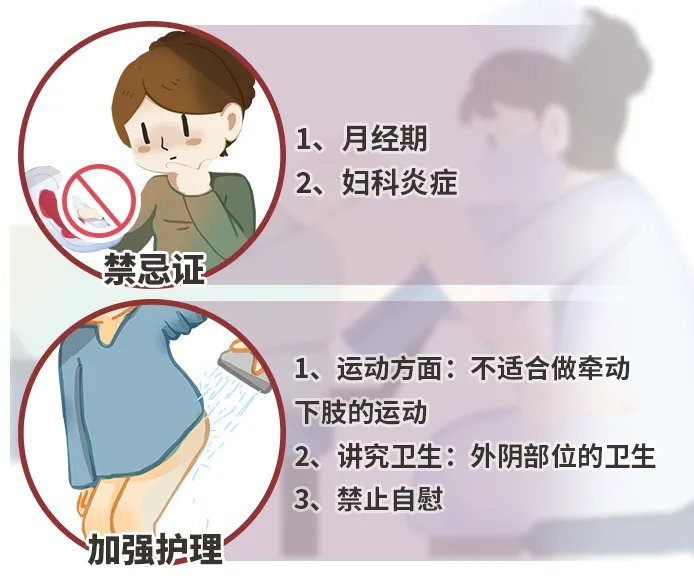 处女膜修复术