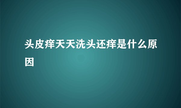 头皮痒天天洗头还痒是什么原因
