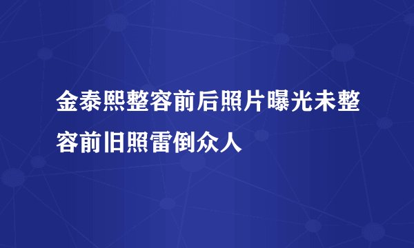 金泰熙整容前后照片曝光未整容前旧照雷倒众人