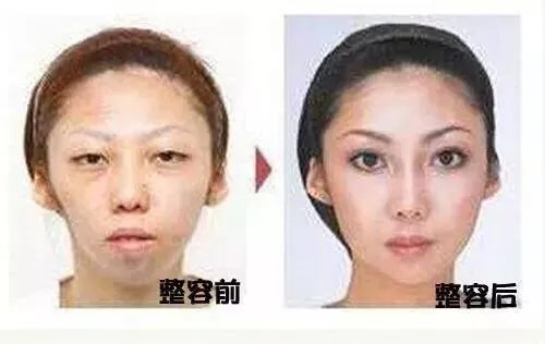 男子嫌老婆太丑,将其告上法庭获赔75万,你怎么看?