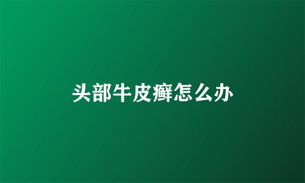 头部牛皮癣怎么办