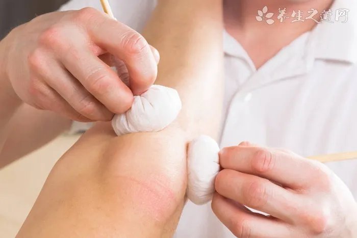 烫伤擦什么药