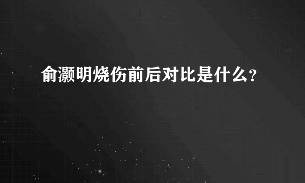 俞灏明烧伤前后对比是什么？