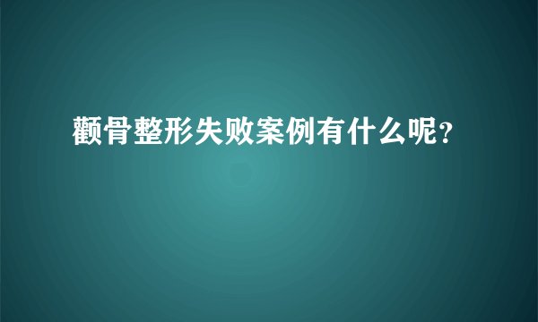 颧骨整形失败案例有什么呢?