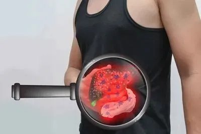 肝胆排毒的最好方法有哪些 6肝胆排毒方法盘点